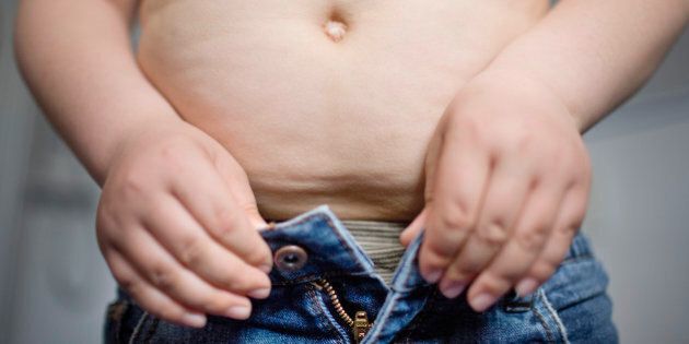 BERLIN, GERMANY - APRIL 14: Overweight boy gets dressed on April 14, 2009 in Berlin, Germany. Obesity is most commonly caused by a combination of excessive food energy intake, lack of physical activity, and genetic susceptibility. (Photo by Thomas Trutschel/Photothek via Getty Images)