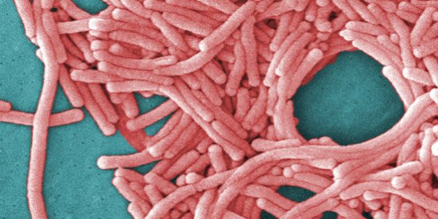 This undated image made available by the Centers for Disease Control and Prevention shows a large grouping of Legionella pneumophila bacteria (Legionnaires' disease). Most deaths from Legionnaires' disease are tied to hospital and nursing home showers, not outdoor cooling towers, new government figures released Thursday, Aug. 13, 2015 show. The germ spreads into the lungs through water vapor or mist. (Janice Haney Carr/Centers for Disease Control and Prevention via AP) .