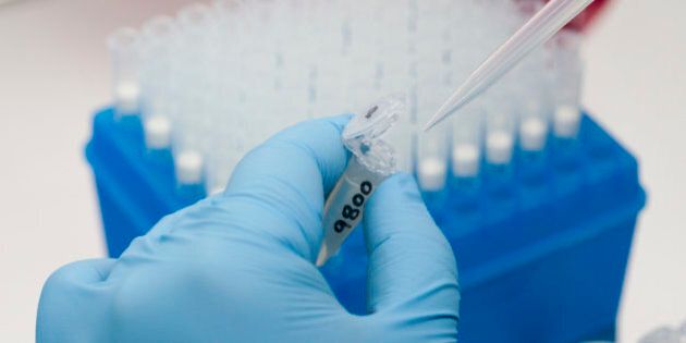 A medical researcher works on results of tests for various diseases, including Zika, at the Gorgas Memorial laboratory Panama City, Friday, Feb. 5, 2016. Panamanian authorities announced Monday that 50 cases of the Zika virus infection have been detected in Panama's sparsely populated Guna Yala indigenous area along the Caribbean coast where they are conducting an aggressive campaign to contain the spread of the virus. (AP Photo/Arnulfo Franco)