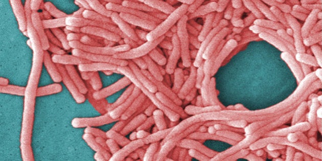 This undated image made available by the Centers for Disease Control and Prevention shows a large grouping of Legionella pneumophila bacteria (Legionnaires' disease). Most deaths from Legionnaires' disease are tied to hospital and nursing home showers, not outdoor cooling towers, new government figures released Thursday, Aug. 13, 2015 show. The germ spreads into the lungs through water vapor or mist. (Janice Haney Carr/Centers for Disease Control and Prevention via AP) .