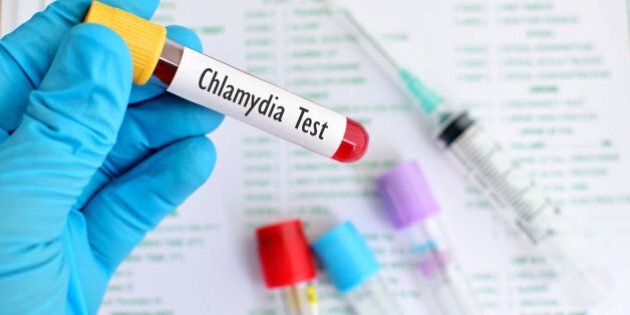 Blood sample for Chlamydia trachomatis (bacteria) test
