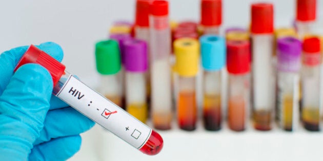 Blood sample with HIV negative