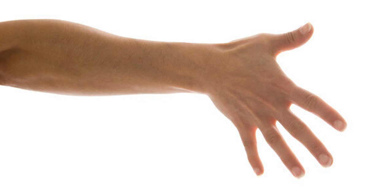 Une première greffe de main et d'avantbras réalisée au Canada