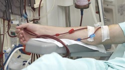 Santé publique: la hausse des taux d'insuffisance rénale indique la nécessité d'une