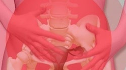 Vivre avec le plus mortel des cancers