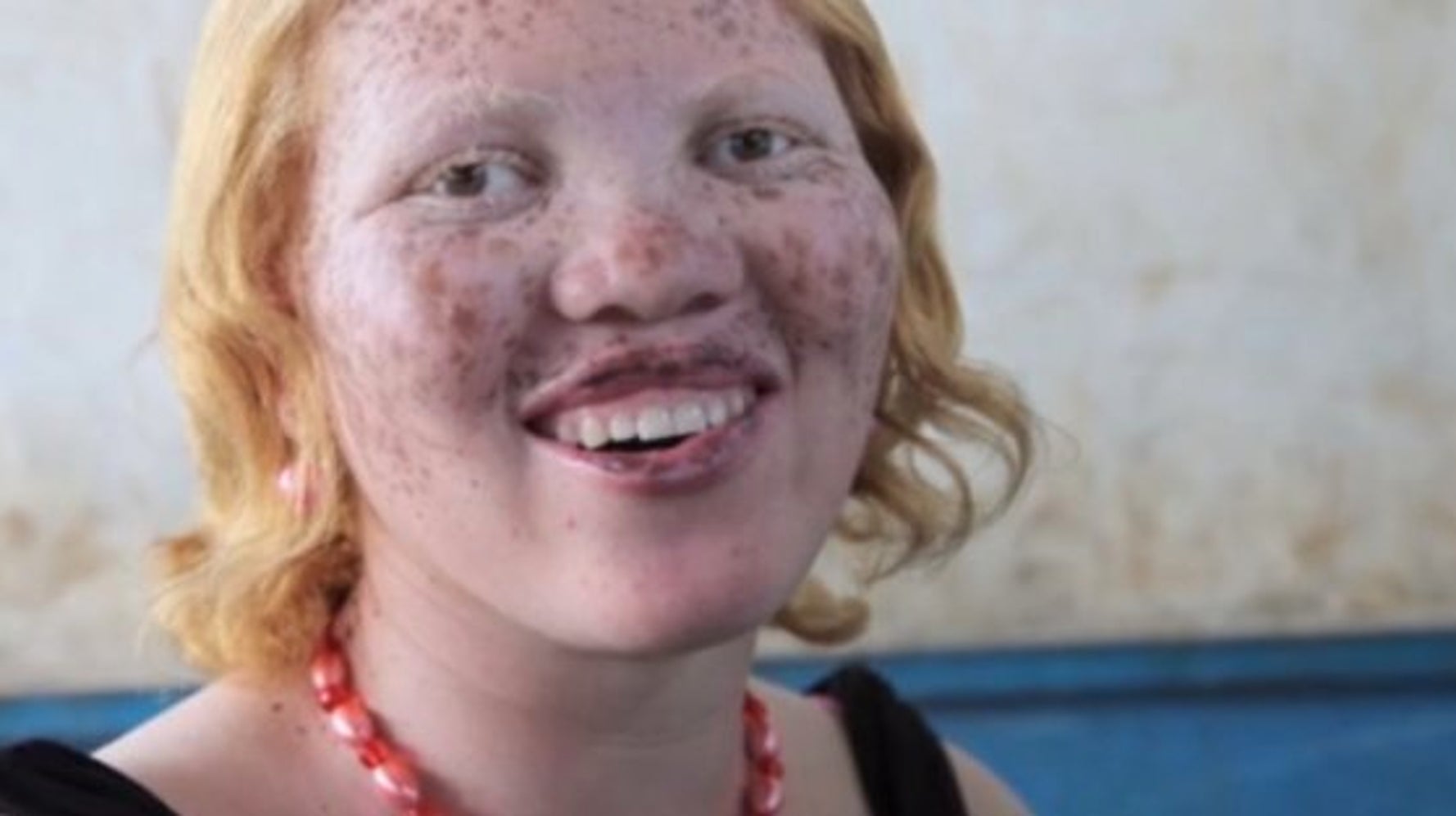 Rick Guidotti Souhaite Mettre De L Avant La Beaute Des Conditions Genetiques Visibles Dans Un Documentaire Huffpost Vivre Rick Guidotti Souhaite Mettre De L Avant La Beaute Des Conditions Genetiques Visibles Dans Un Documentaire Huffpost Vivre