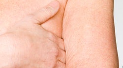 Cancer du sein: la désescalade