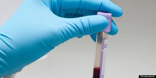 hand holding blood in test tube