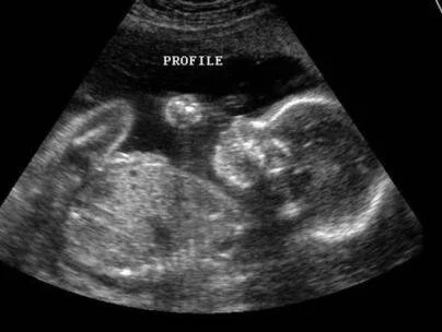 Un Homme Peut Il Cogner La Tete De Bebe En Faisant L Amour A Sa Femme Enceinte Huffpost Null Un Homme Peut Il Cogner La Tete De Bebe En Faisant L Amour A Sa Femme Enceinte Huffpost Null