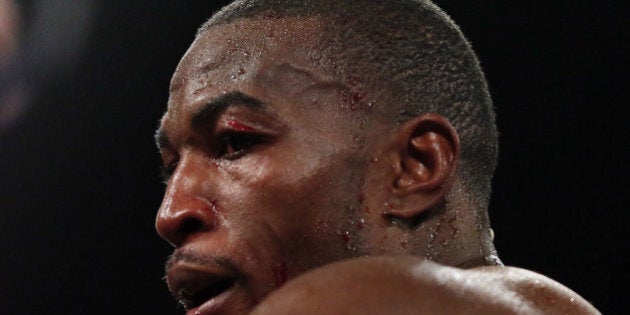 NEW YORK, NY - MARCH 09: Tavoris Cloud waits to have his eye looked at during a stop in the fight against Bernard Hopkins during the IBF Light Heavyweight Title fight on March 9, 2013 at Barclays Center in the Brooklyn borough of New York City. (Photo by Elsa/Golden Boy/Golden Boy via Getty Images)