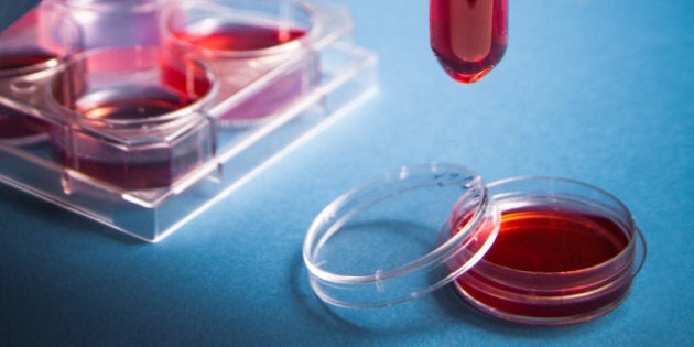 biochemistry of blood tests....