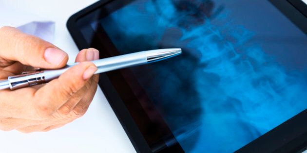 Doctor using digital digital tablet, checking spine X-Ray.