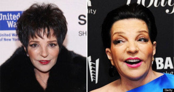 Liza Minnelli et la chirurgie esthétique: la chanteuse de «Cabaret» est méconnaissable
