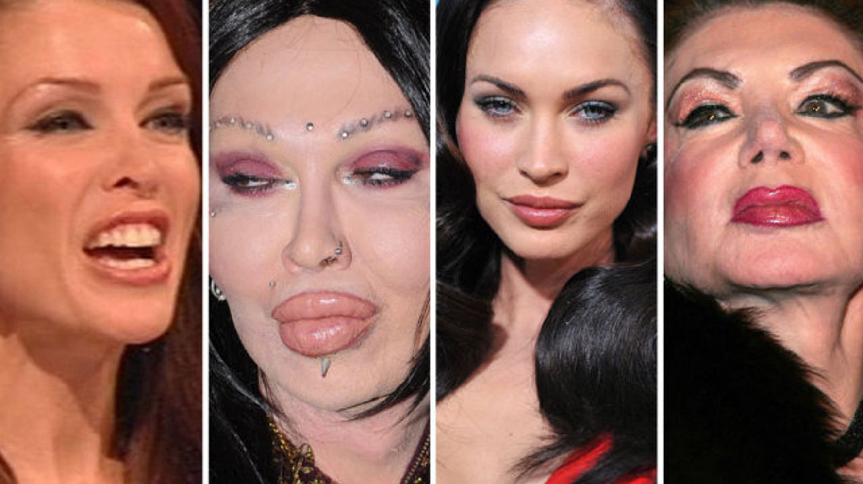 La chirurgie (parfois ratée) des stars (PHOTOS) HuffPost Vivre La chirurgie (parfois ratée) des stars (PHOTOS) HuffPost Vivre