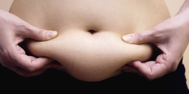 Obese women shows fat on her stomach, Photography