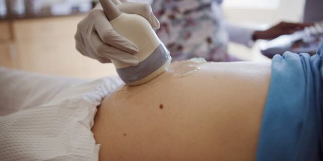 Pregnancy Ultra-Sound