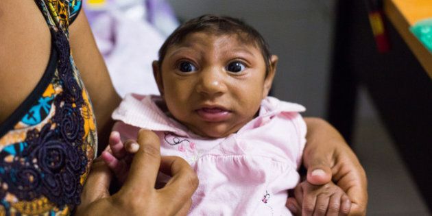 RECIFE, BRAZIL - FEBRUARY 02, 2016: Jocilene Goncalo de Lima, 30, with her baby Evelyn Vitoria at the Instituto Materno Infantil Professor Fernando Figueira on February 02, 2016, in Recife, Brazil.CRYING and helpless, these disfigured babies are the latest victims of what some scientists are calling a bigger threat than HIV. The city of Recife on Brazils tropical north-east coast is the epicentre of the Zika virus outbreak, which is has been linked to thousands of cases of microcephaly. At the forefront of the citys epidemic is the IMIP Hospital. Among the patients seen at the treatment centre on Tuesday, February 2, were a pair of twins where one of the newborns had been born with microcephaly and the other without. Brazils Health Ministry estimates roughly between 500,000 and 1.5 million people are infected with Zika in the country. Experts suspect the mosquito-borne virus in pregnant women can cause microcephaly in babies, but concrete evidence has yet to surface.PHOTOGRAPH BY Clara GouvÃªa / Barcroft MediaUK Office, London.T +44 845 370 2233W www.barcroftmedia.comUSA Office, New York City.T +1 212 796 2458W www.barcroftusa.comIndian Office, Delhi.T +91 11 4053 2429W www.barcroftindia.com (Photo credit should read Barcroft Media / Barcroft Media via Getty Images)