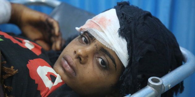Le 9 juin 2018, au Yémen, une jeune fille blessée reçoit des soins à l'hôpital Althawra, à Hodeidah.
