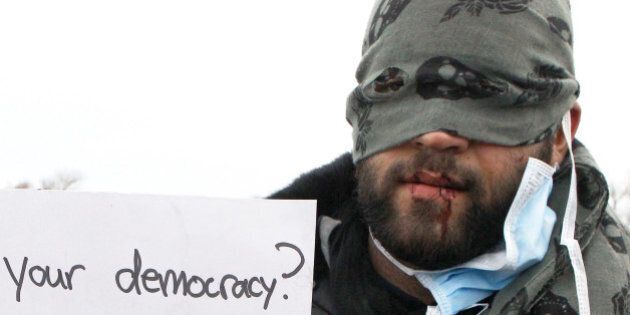 A hooded unidentified migrant from Iran demonstrates with his sewn lips, in an attempt to prevent the dismantling of makeshift dwellings at a camp near Calais, France, Wednesday March 2, 2016. More than a dozen humanitarian organizations on Tuesday accused authorities of brutally evicting migrants from their makeshift dwellings in a sprawling camp in northern France, as fiery protests of the demolition continued. (AP Photo/Michel Spingler)