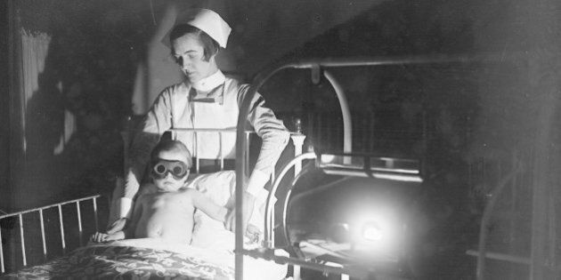 A child wearing goggles and held by a nurse, undergoes sun-ray treatment at Cheyne Hospital for Children, Chelsea.