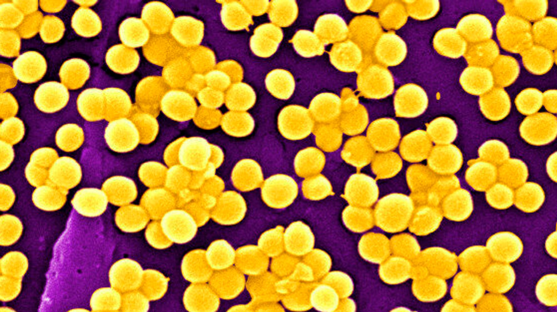 New Strategy Cracks Staph Bacterium's Golden Armor, Making It Vulnerable  To Treatment