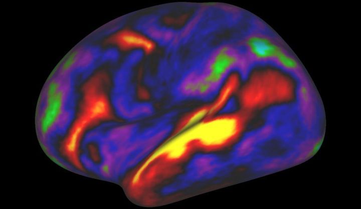 The image shows the pattern of brain activation (red, yellow) and deactivation (blue, green) in the left hemisphere when listening to stories while in the MRI scanner.