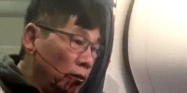 Dr David Dao, who declined to give up his seat on a United Airlines flight, recently sued the carrier.