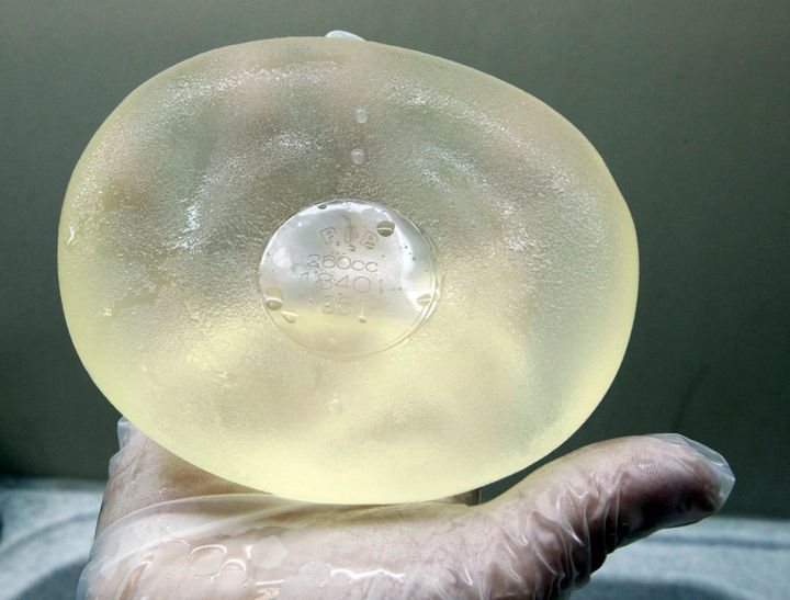 A cleaned defective silicone gel breast implant, manufactured by French company Poly Implant Prothese (PIP), after it was removed from a patient by plastic surgeon Denis Boucq.