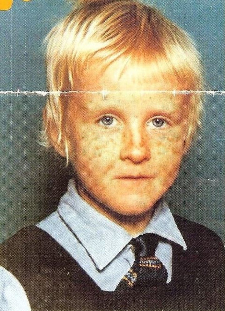 Michele Joyce during treatment aged 5.