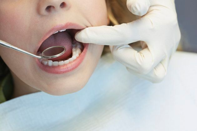Tooth decay in Australian children is on the rise.