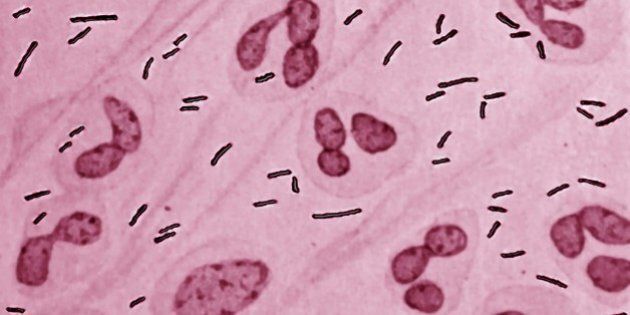 Escherichia coli bacterium (also known as E. Coli) from the Enterobacteriaceae family. Certain stems of escherichia coli are the cause of various pathologies : diarrhea, gastroenteritis, urinary infections, meningitis, septicemia. Seen through an optical microscope.