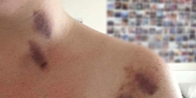 The photo posted online, claiming to show the injuries caused in the alleged assault