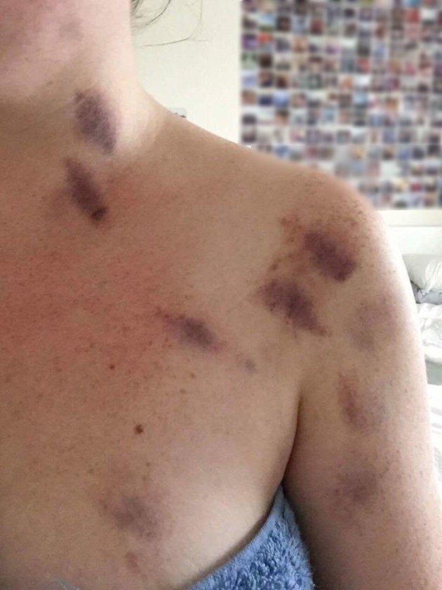 The photo posted online, claiming to show the injuries caused in the alleged assault