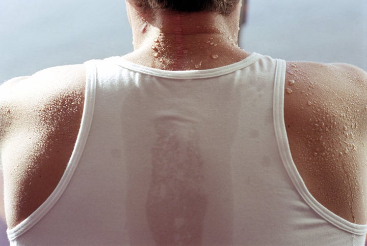 Sweat is a common by-product of exercise, but it can also trigger 'sweating hives'.