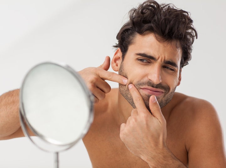 Testosterone causes blackheads. Who knew?