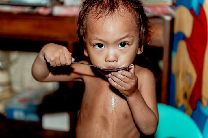 An undernourish young toddler licks a spoon after eating some rice.