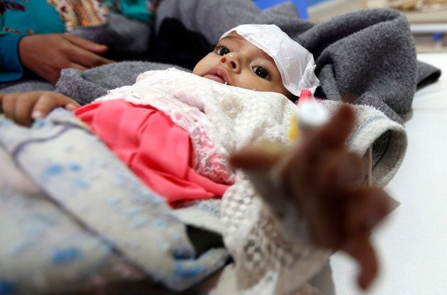 A Yemeni infant suspected of being infected with cholera receives treatment at Sabaeen Hospital in Sanaa.