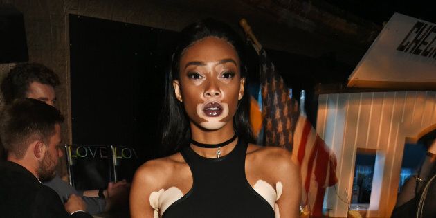 LONDON, ENGLAND - SEPTEMBER 19: Winnie Harlow attends LOVE Magazine and Marc Jacobs LFW Party to celebrate LOVE 16.5 collector's issue of LOVE and Berlin 1989 at Loulou's on September 19, 2016 in London, England. (Photo by David M. Benett/Dave Benett/Getty Images for LOVE / CONDE NAST)