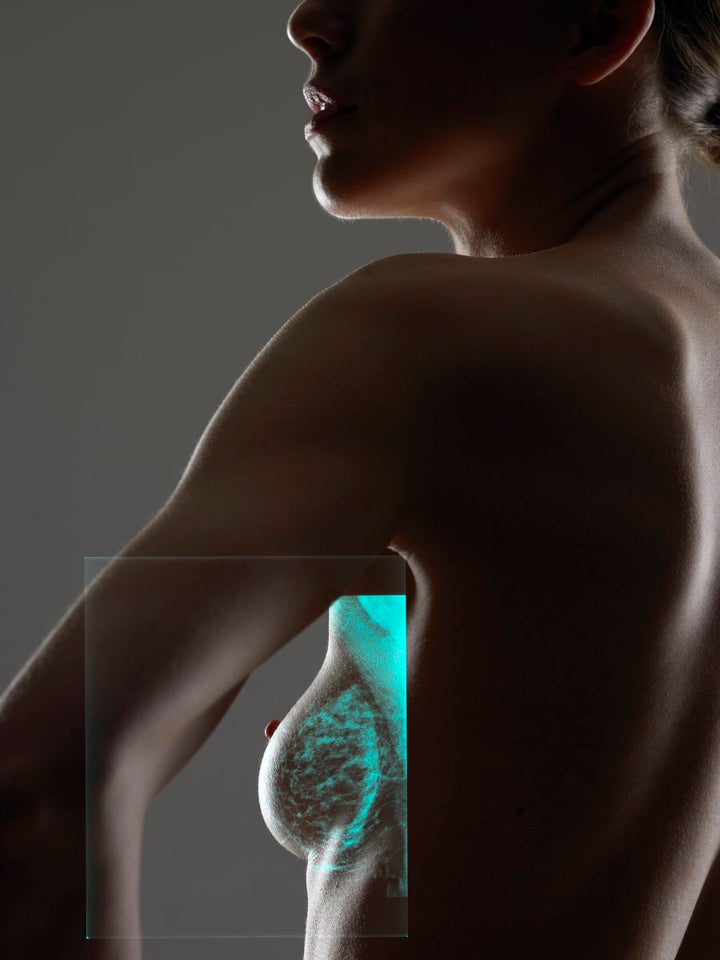 Women with augmentation implants can and should undergo mammograms.