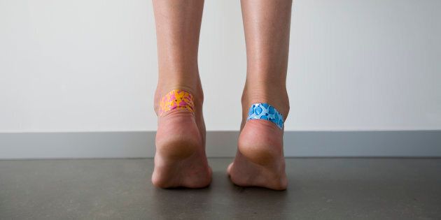 girl with adhesive plasters on the blisters on her