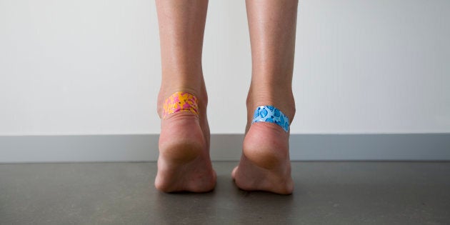 girl with adhesive plasters on the blisters on her