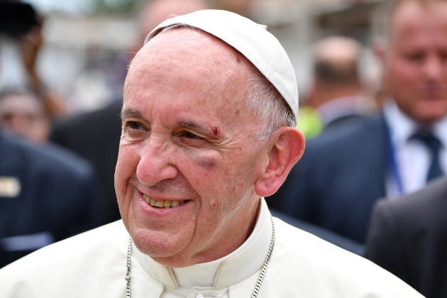 Pope Francis shows a bruise around his left eye and eyebrow caused by an accidental hit against the popemobile's window glass.