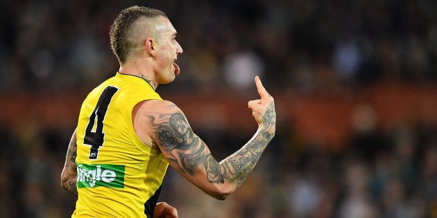 In our opinion, Brownlow Medal Favourite Dustin Martin manages to look silly no matter what colour he's wearing.