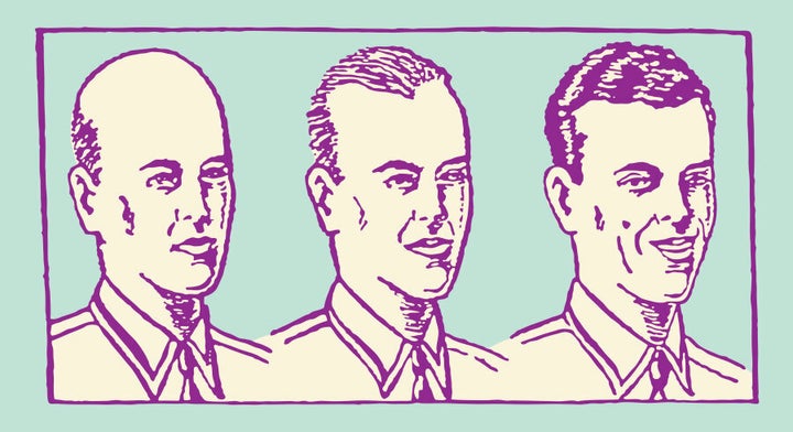 A helpful diagram of a man in the varying stages of baldness.