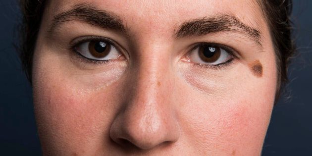 NEW YORK, NY - AUGUST 17: Jamie Feldman poses for a portrait with untouched eyebrows before and eyebrow experiment in New York on Wednesday, Aug. 17, 2016. (Photo by Damon Dahlen, Huffington Post) *** Local Caption ***