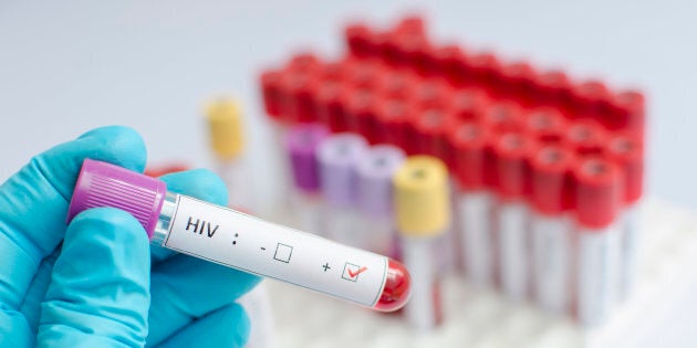 Treatment that would suppress HIV levels without the need for antiretroviral therapy would be considered a “functional” cure.