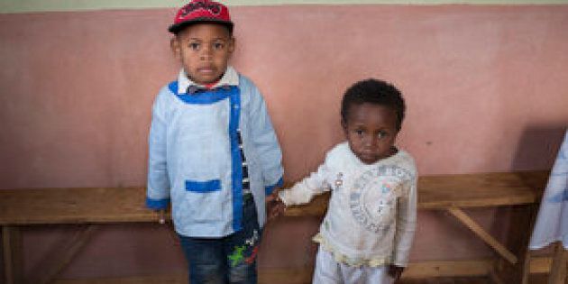 Miranto (left) and Sitraka were born on the same day in the same Madagascar village, but Sitraka is chronically malnourished.