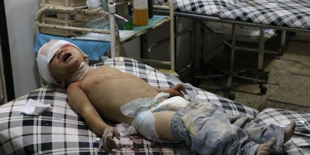 A wounded toddler waits to receive medical treatment following an airstrike over the civilian populated residential areas.