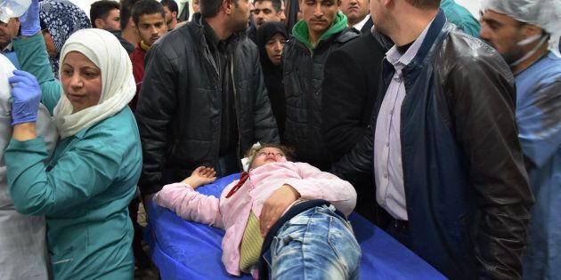 An injured Syrian girl lies on a stretcher at a hospital in the government-held side of west Aleppo, on November 20, 2016, following reported rocket fire by the opposition forces that hold the eastern part of the city.At least seven children were killed by rebel rocket fire that hit a school in the government-held west of Aleppo city, state media said. Government forces are currently waging a ferocious assault against east Aleppo, targeting it with air strikes, barrel bombs and artillery fire. / AFP / GEORGE OURFALIAN (Photo credit should read GEORGE OURFALIAN/AFP/Getty Images)