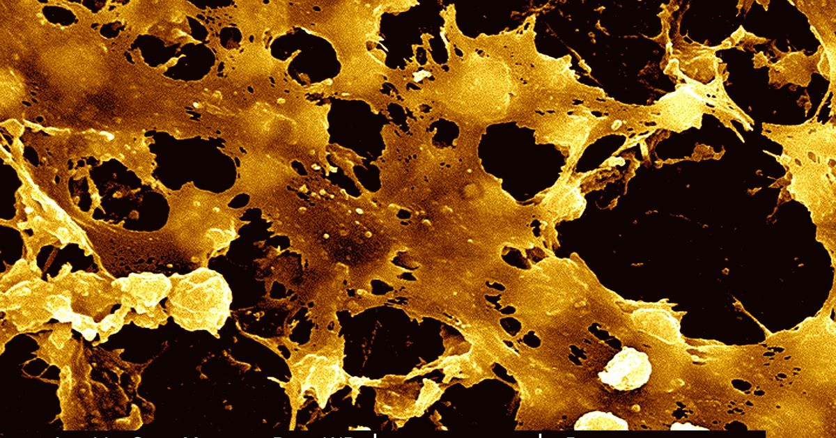 New Strategy Cracks Staph Bacterium's Golden Armor, Making It Vulnerable  To Treatment